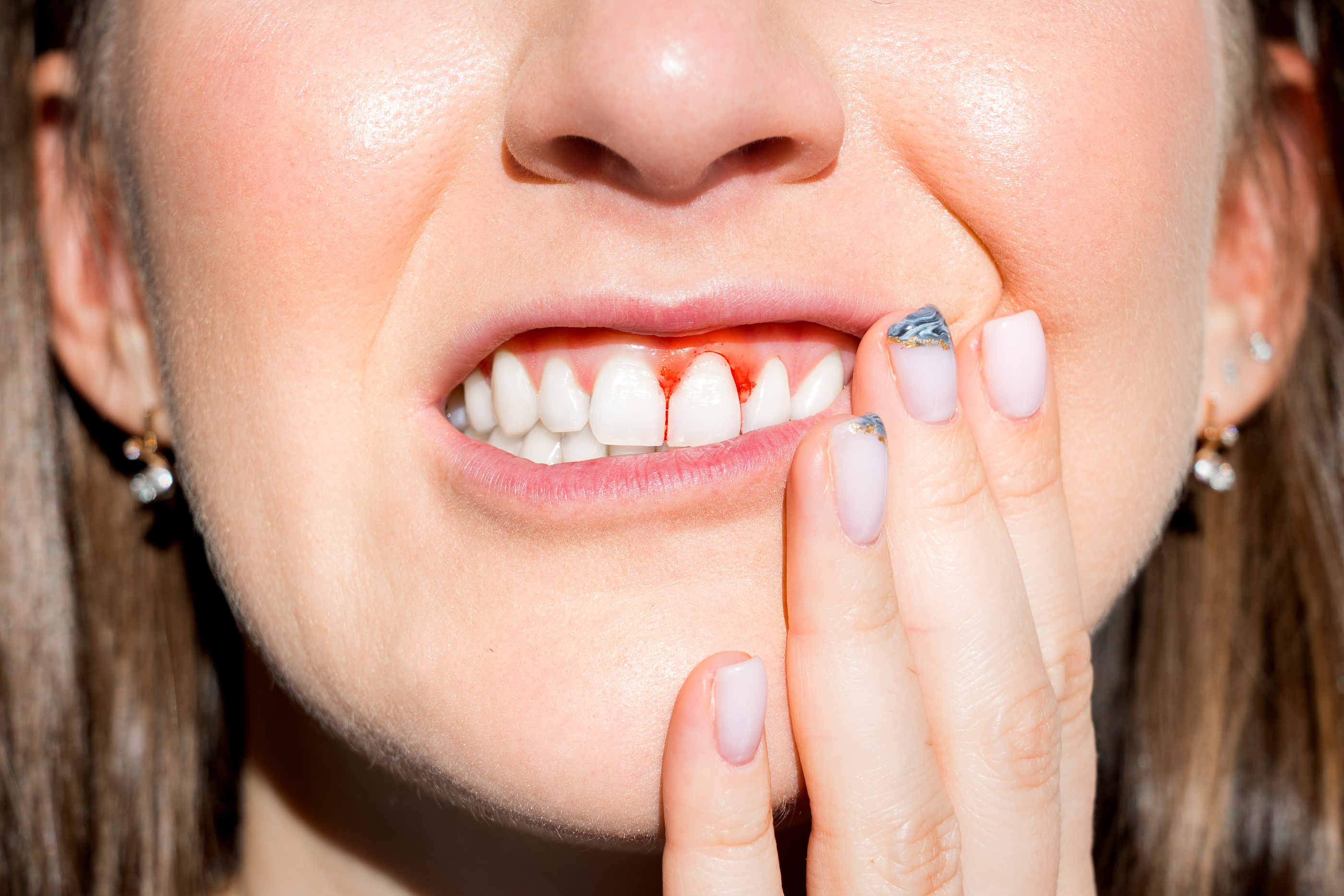 Understanding Gum (Periodontal) Disease Understanding Gum (Periodontal) Disease